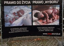Cenzura ws. handlu organami abortowanych dzieci