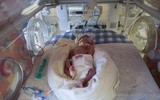 Matka nie żyła od 55 dni. Dziecko urodziło się żywe