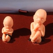 Szef watykańskiej dyplomacji: aborcja nie jest „prawem człowieka”