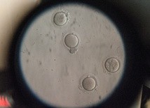 Zgoda na hodowlę ludzkich embrionów