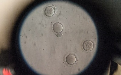 Zgoda na hodowlę ludzkich embrionów