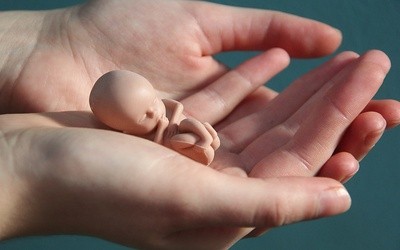 "Zdjęcia ciał dzieci poddanych aborcji pokazują prawdę, ale cel nie uświęca środków"