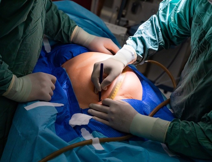 Polscy ginekolodzy będą operować kobiety w jednym z najuboższych krajów świata